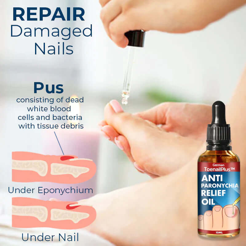 ToenailPlus™ Anti Paronychia Relief Oil